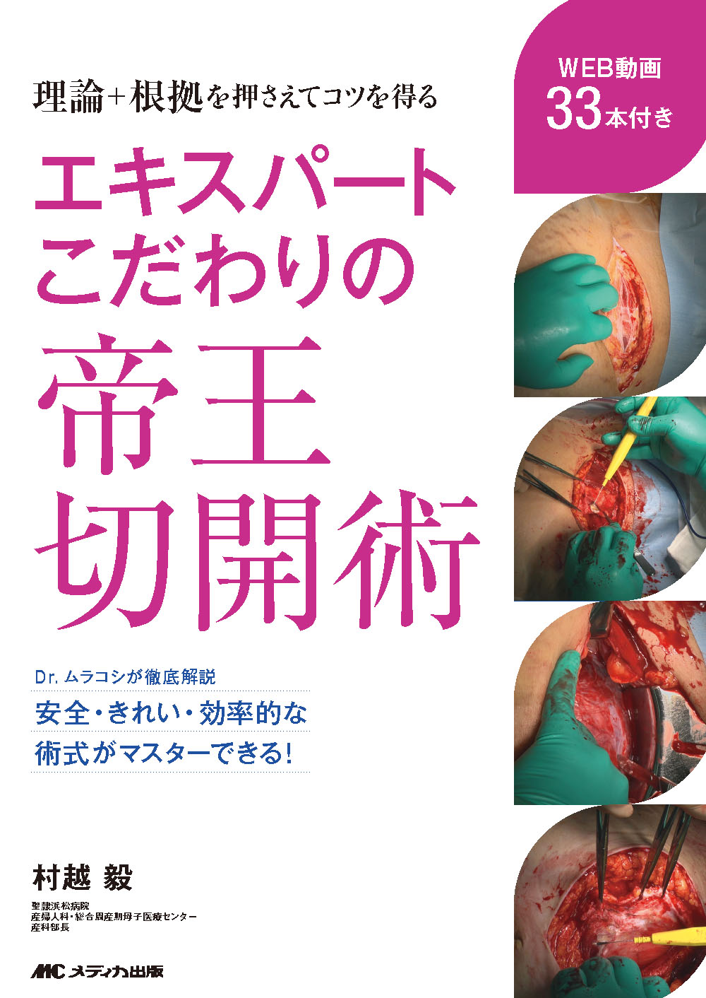 エキスパートこだわりの帝王切開術 エキスパートこだわりの帝王切開術